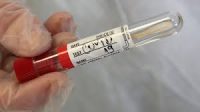 ���������� �� �������� ��� PCR ����
